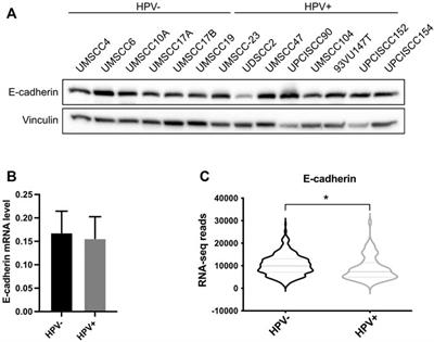 The UBC9/SUMO pathway affects E-cadherin cleavage in HPV-positive head and neck cancer